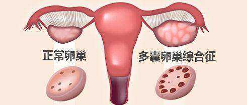 巢湖试管婴儿助孕费用全攻略：代生代怀价格明细与生育预算指南